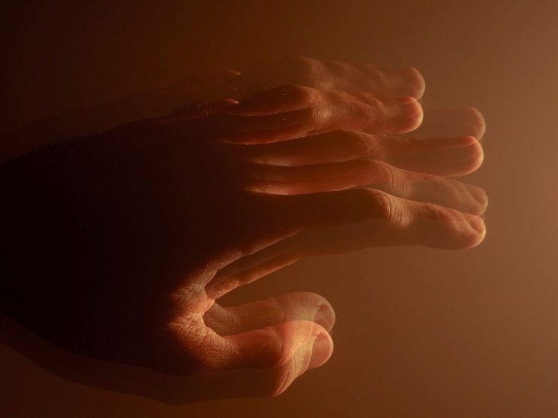 New cells in the brain gives hope for patients with Parkinson’s disease