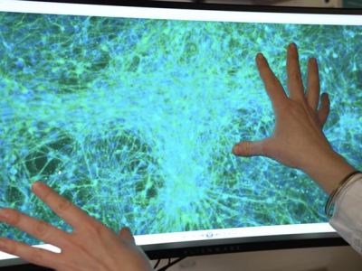 New stem cell therapy against Parkinson’s being tested in Lund: “Huge&nbsp;progress”